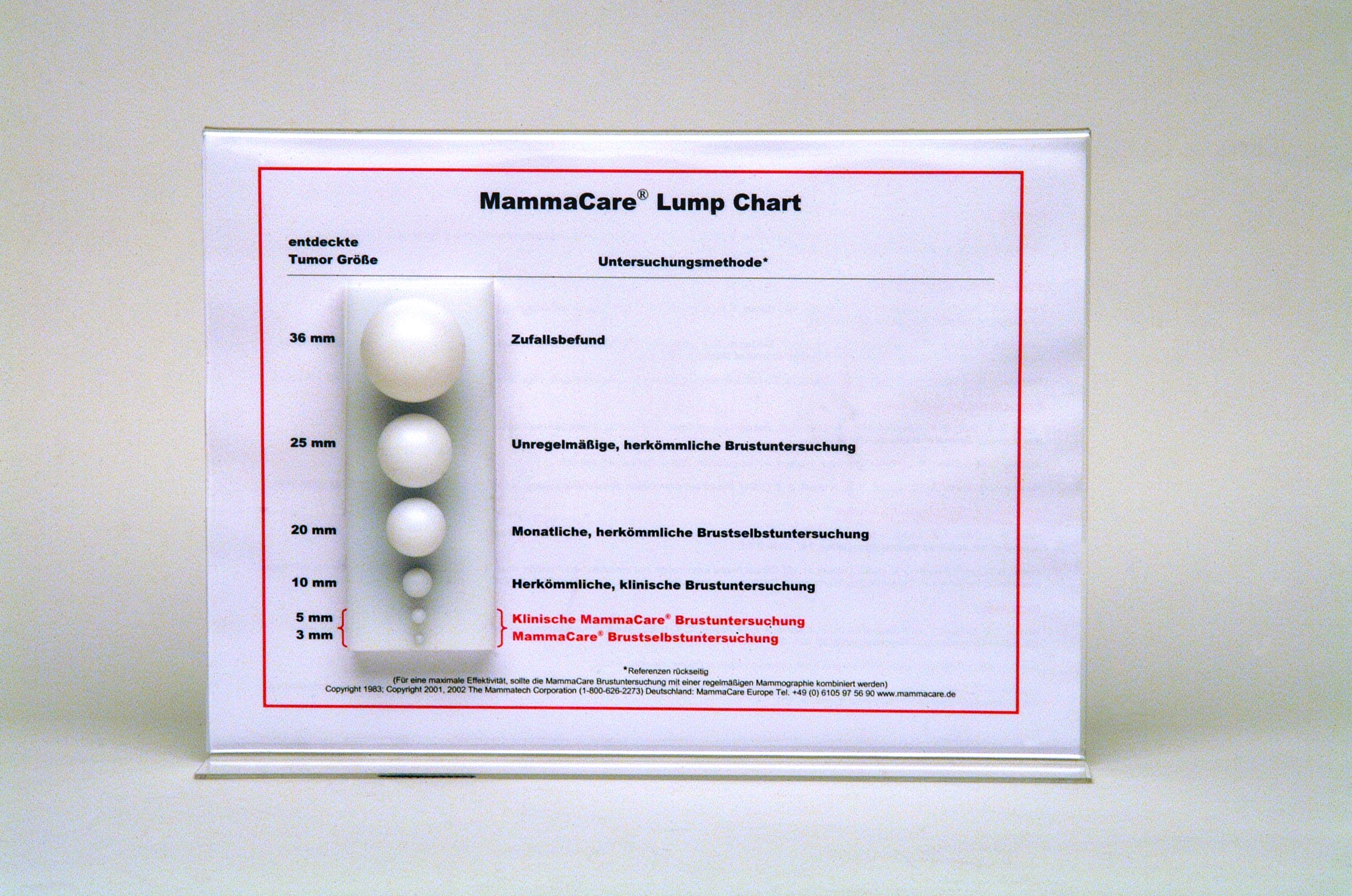 Lump Chart (Knotenmodell)